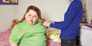 Η 12χρονη που ζυγίζει 92 κιλά -Μία σπάνια ασθένεια είναι η αιτία που παχαίνει χω