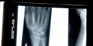 Επιστημονικές ...γκάφες που άλλαξαν τον κόσμο – Δέκα ατυχήματα που έγιναν οι καλ