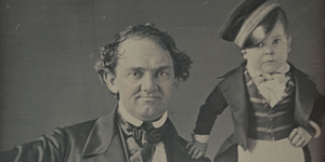 Η αρρώστια των Freak Shows: Οταν τυχοδιώκτες εκμεταλλεύονταν τις γενετικές ανωμα