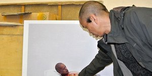 Σοκαριστική σκηνή: Αφαίρεσε το πλευρό του χωρίς αναισθητικό και το φόρεσε στο λα