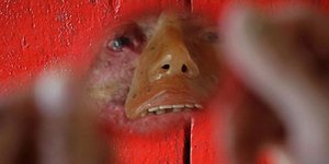 Το χωριό με τους κατοίκους που «λιώνουν» -Μία σπάνια ασθένεια καταστρέφει το δέρ