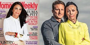 Το σύμβολο της δύναμης -Παραλίγο να πεθάνει από σοβαρά εγκαύματα