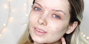 Φωτογραφία:mypaleskinblog