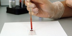 φωτογραφία: pixabay.com