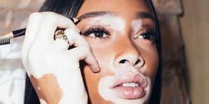 Instagram/Winnie Harlow