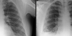 Φωτογραφία: BMJ Case Reports