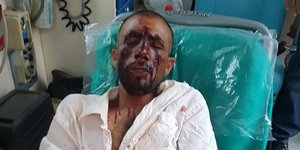 Ακολουθούν σκληρές εικόνες / Φωτογραφία: ΚΕΕΡΦΑ 