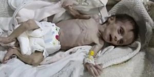 Η μόλις 1 μηνός Σαφάρ πέθανε από την πείνα