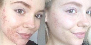 Instagram/asprinkleofhealthandbeauty