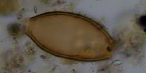 Φωτογραφία:piers mitchell / Για πρώτη φορά: Ανακαλύφθηκαν στην Τζια τα παρασιτικά σκουλήκια που περιέγραφε ο Ιπποκράτης πριν 2.500 χρόνια [εικόνες]