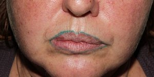 Φωτογραφία: Supplied/   Γυναίκα ταξίδεψε από την Αυστραλία έως την Ταϊτή για να κάνει τατουάζ στα χείλη της- Το αποτέλεσμα ήταν για γέλια [εικόνες]