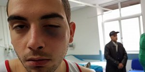 Φωτογραφία: notia.gr- O 20χρονος νεαρός που δέχτηκε επίθεση στο γυμναστήριο