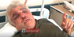 Θύμα ληστείας στην Κεφαλονιά/ Φωτογραφία inkefalonia