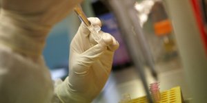 Αύξηση 6% τον χρόνο στα περιστατικά καρκίνου του εντέρου/Φωτογραφία: AP