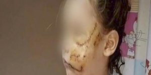 Η μική Δήμητρα που δέχθηκε την άγρια επίθεση από το πιτ μπουλ στο Ιλιον -Φωτογραφία: Youtube