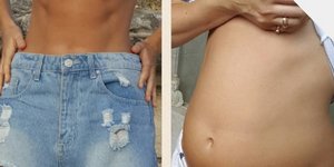 Η κοιλιά του μοντέλου πριν και μετά /Φωτογραφία: instagram/alycecrawford