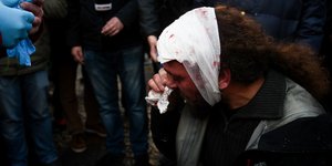 Ο φωτορεπόρτερ μετά την επίθεση που δέχθηκε / Φωτογραφία: EUROKINISSI / ΤΑΤΙΑΝΑ ΜΠΟΛΑΡΗ