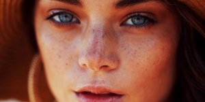 Γυναίκα με φακίδες στο πρόσωπο. Φωτογραφία:Unsplash
