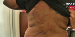 Ξυλοδαρμός άνδρα στα Εξάρχεια