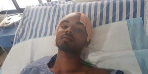 Ινδός στο κρεβάτι νοσοκομείου με τραύμα στο κεφάλι