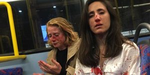 Οι δύο γυναίκες που ξυλοκοπήθηκαν