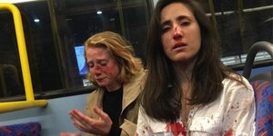  Οι δύο γυναίκες που ξυλοκοπήθηκαν άγρια