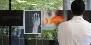 Γιατρός κοιτάζει ακτινογραφίες γυναικών που υπέστησαν ενδοοικογενειακή βία