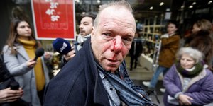 Ακροδεξιοί επιτέθηκαν και χτύπησαν τον δημοσιογράφο Θ. Ιακόμπι