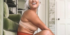 Σώμα γυναίκα με σώμα που έχει κυτταρίτιδα και ραγάδες