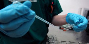 To πειραματικό τεστ αίματος ανιχνεύει 50 τύπους καρκίνου
