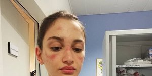 Αλέσια Μπονάρι