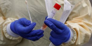 Δειγματοληψία για τεστ κορωνοϊού