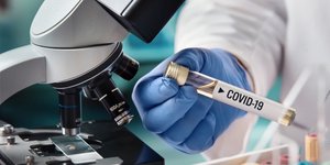 Συνεχίζονται οι έρευνες για τη θεραπεία του κορωνοϊού