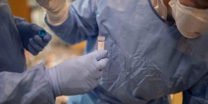 κορωνοϊός γιατρός δείγμα εξέταση