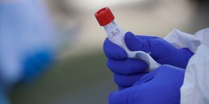 κορωνοϊός γιατρός γάντια φιάλη αίμα εξέταση