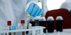 Δείγματα για τον κορωνοϊό