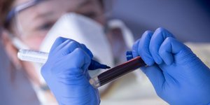 Κορωνοϊός: Τουλάχιστον 456.630 οι νεκροί σε όλο τον κόσμο