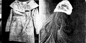 Επίθεση με βιτριόλι: Ολη η δικογραφία, πώς έφτασε η ΕΛΑΣ μέχρι την σύλληψη -Φωτογραφίες ντοκουμέντα 