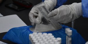 γαντια τεστ μπουκαλακια 