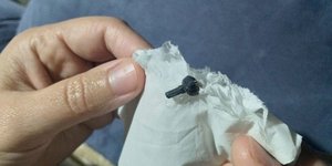 Το κομμάτι Lego που βγήκε μετά από δύο χρόνια από τη μύτη του 7χρονου