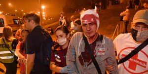 Tραυματισμένος διαδηλωτής στο Μινσκ της Λευκορωσίας