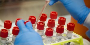 κορωνοϊός εργαστήριο