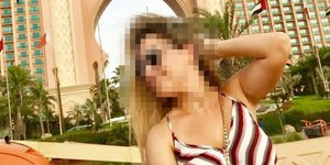 Η 34χρονη θύμα επίθεσης με βιτριόλι