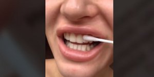 Viral βίντεο με τεχνική λεύκανσης δοντιών στο σπίτι