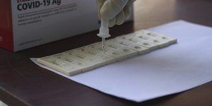 σταγονομετρο