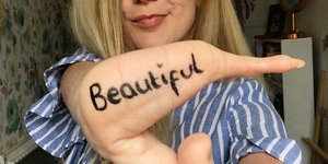 γυναίκα με αναπηρία