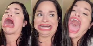 Γυναίκα με πελώριο στόμα 