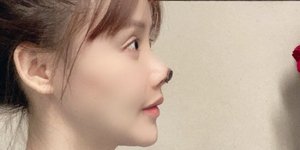 Κινέζα ηθοποιός έμεινε με παραμορφωμένη μύτη, μετά από αισθητική επέμβαση