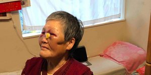 76χρονη Ασιάτισσα