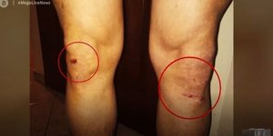 Αστυνομικοί ξυλοκόπησαν πατέρα και γιο στην Κατερίνη: Έπαθε οξύ έμφραγμα ο 58χρονος